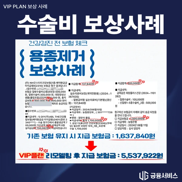 보험 점검 후 용종 제거 보상 보상사례 자료