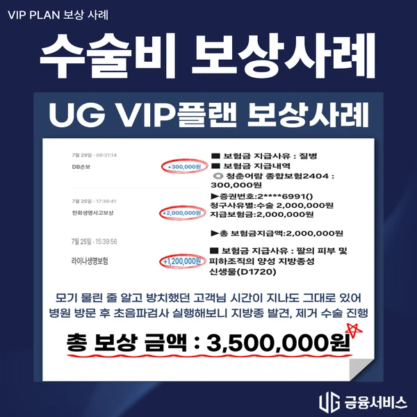 팔 지방종 제거 수술 보상사례 자료