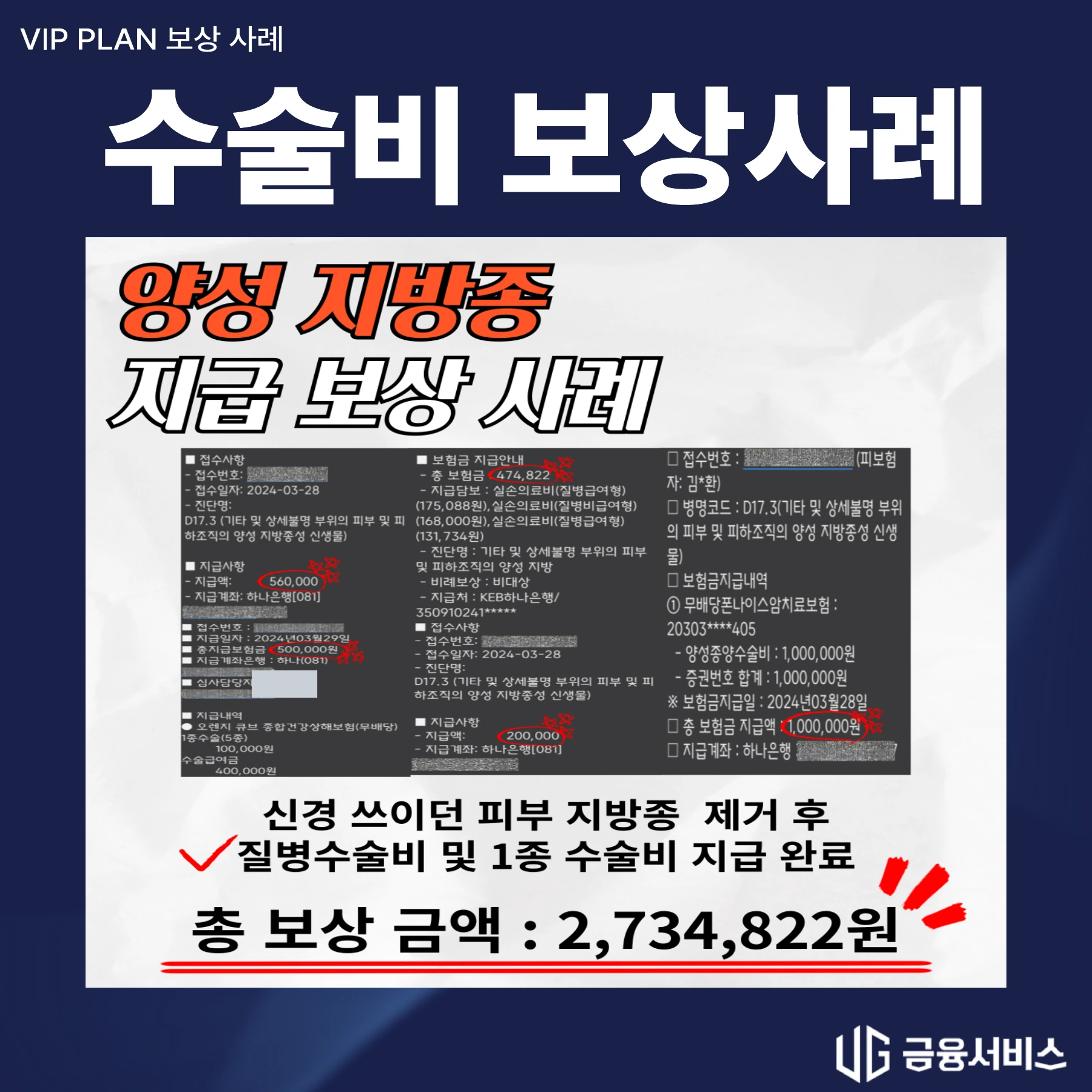 피부 지방종 제거 수술 보상사례 지급 자료